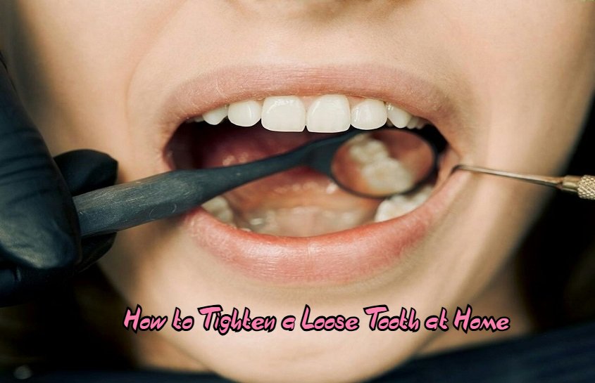 How to Tighten a Loose Tooth at Home: Effective Remedies and Tips